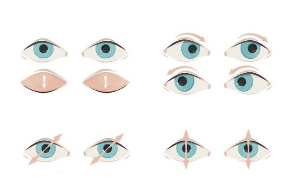 Persona con cansancio visual frente a la pantalla